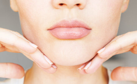 Behandlung von Doppelkinn.