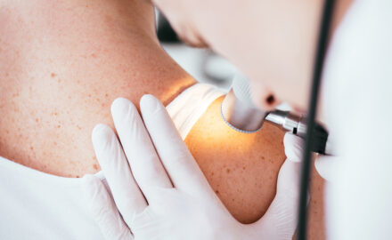 Arzt untersucht Haut auf Hauterkrankungen.