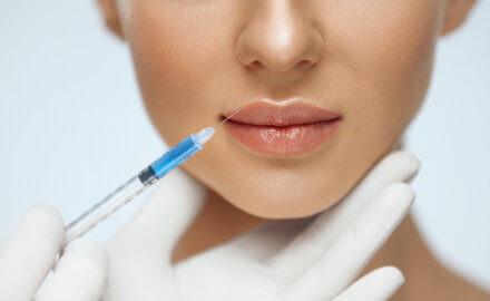 Aufspritzung der Lippen für mehr Lippenvolumen.