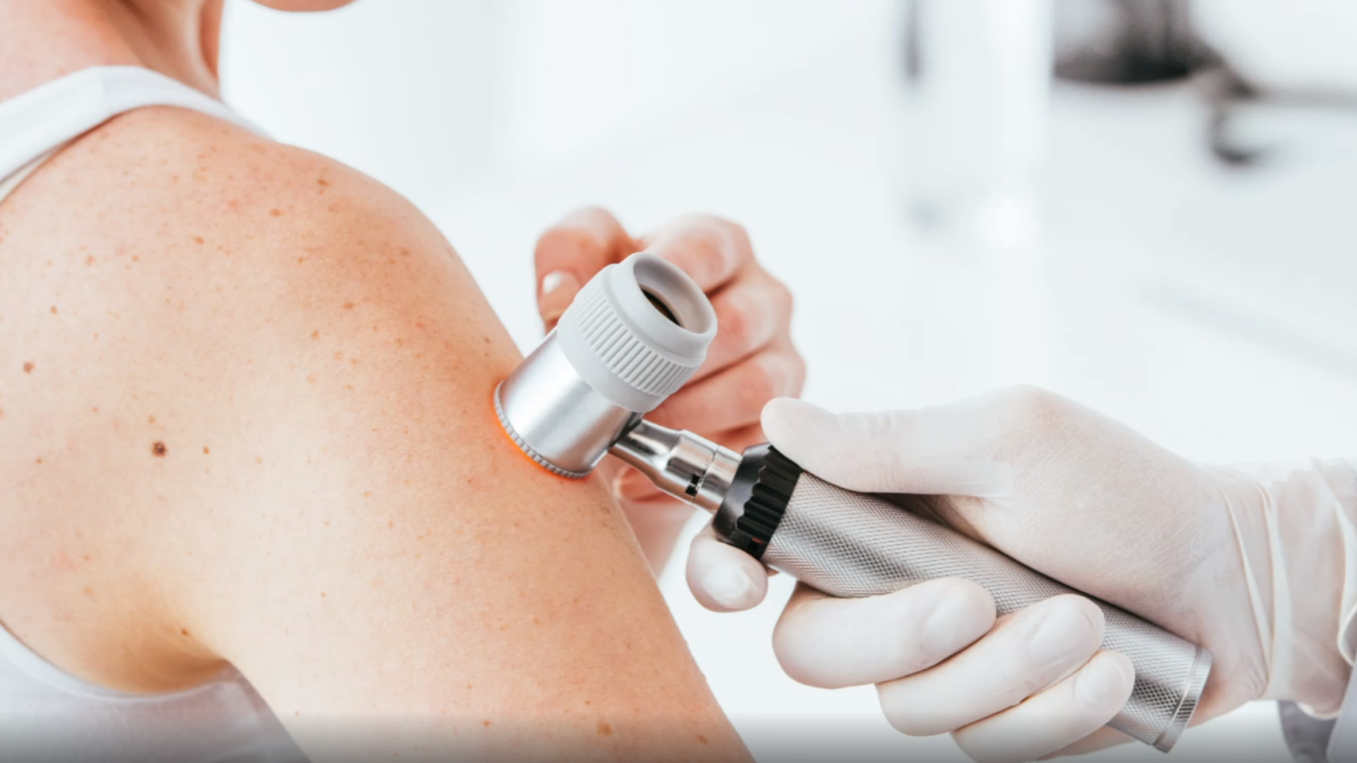 Hautarzt untersucht Haut mit Dermatoskop.