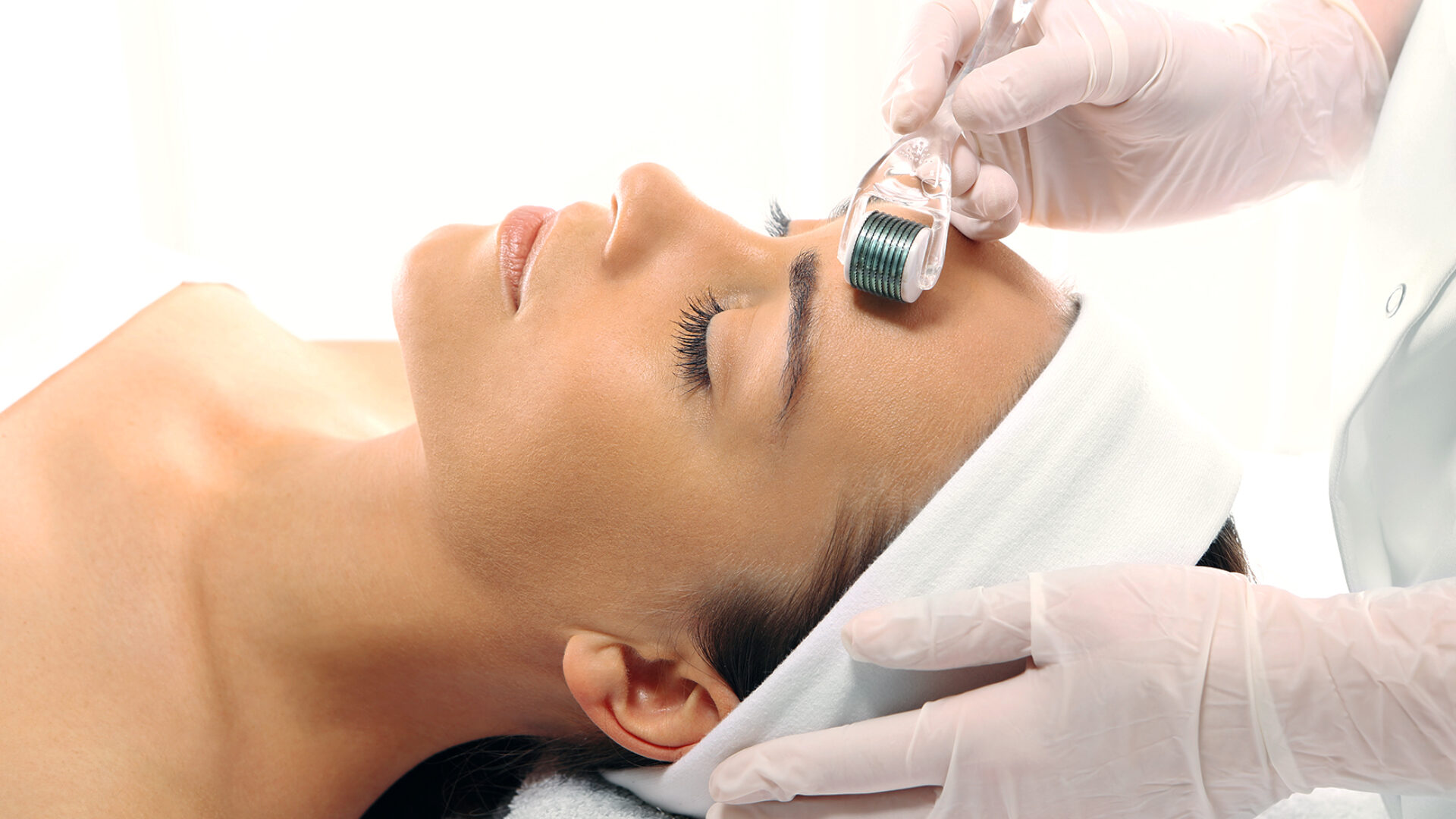Microneedling im Gesicht.