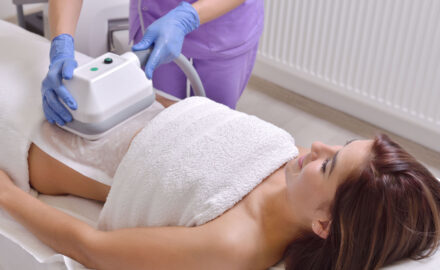 Kryolipolyse einer Frau.