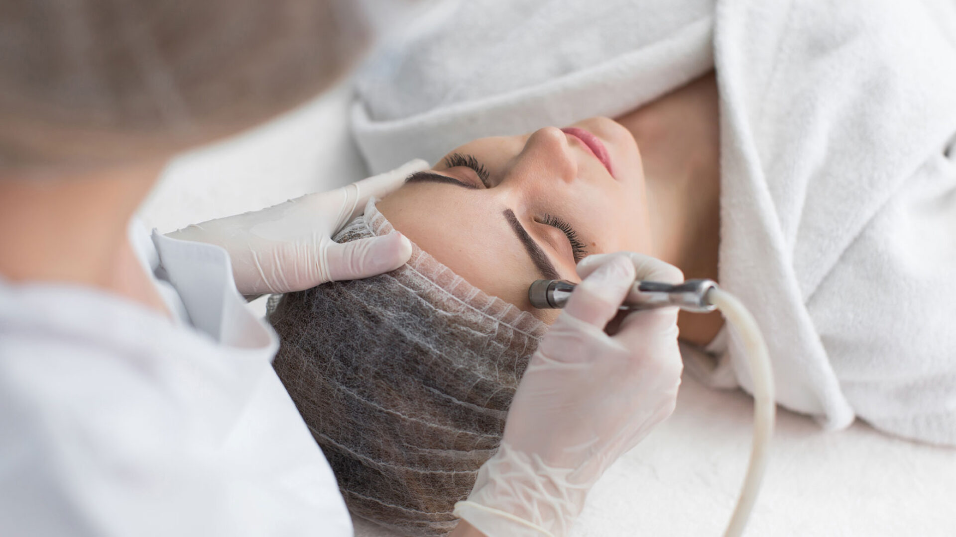 Behandlung durch Microdermabrasion.