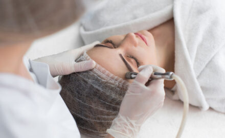 Behandlung durch Microdermabrasion.